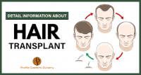 When Does the Implanted Hair Hold and Why Does It Not Grow?